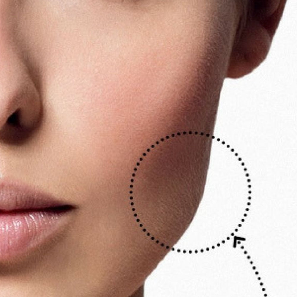 Buccal-Fat