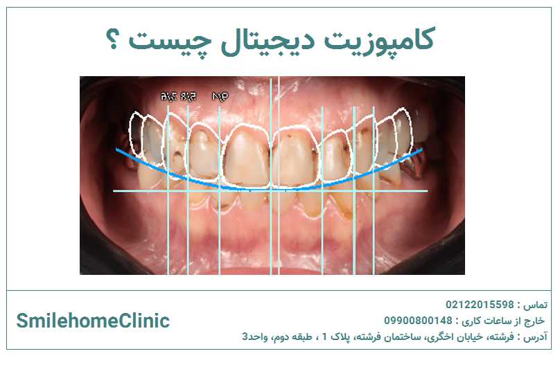 کامپوزیت دیجیتال