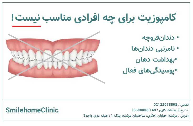 کامپوزیت برای چه کسانی مناسب نیست؟