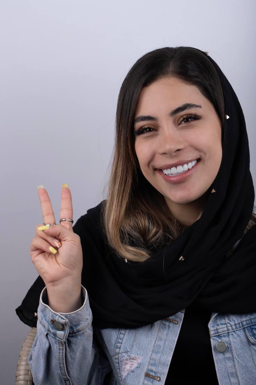 لمینت و کامپوزیت توسط دکتر شبنم کریمی دندانپزشک زیبایی