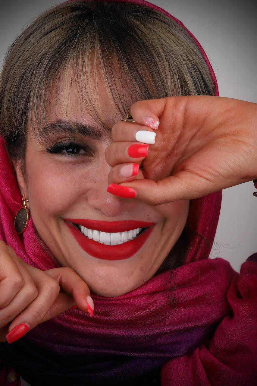 لمینت و کامپوزیت توسط دکتر شبنم کریمی دندانپزشک زیبایی