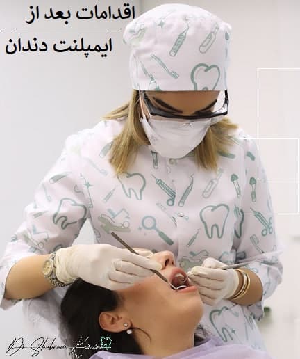 بعد از ایمپلنت دندان