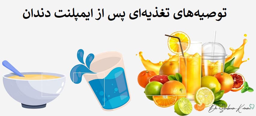 توصیه‌های تغذیه‌ای پس از ایمپلنت دندان