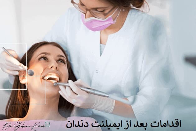 اقدامات بعد از ایمپلنت دندان