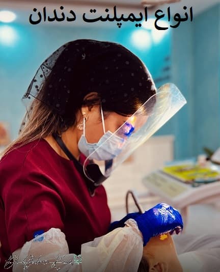 انواع ایمپلنت دندان