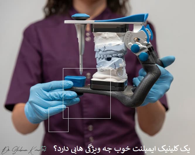 یک کلینیک ایمپلنت خوب چه ویژگی هایی دارد؟