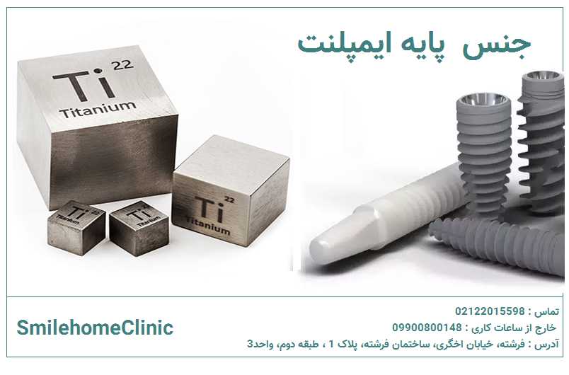 چرا تیتانیوم بهترین گزینه