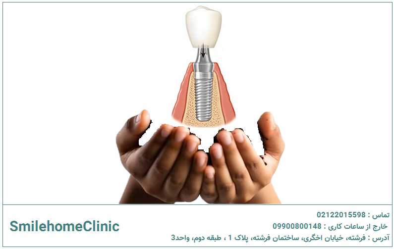 مراقبت و نگهداری