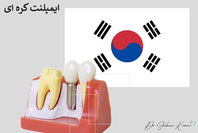 ایمپلنت کره ای