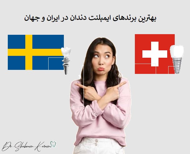 بهترین برندهای ایمپلنت دندان در ایران و جهان
