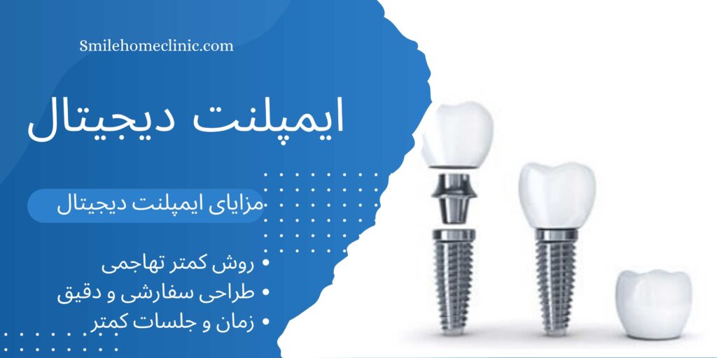 ایملنت دیجیتال