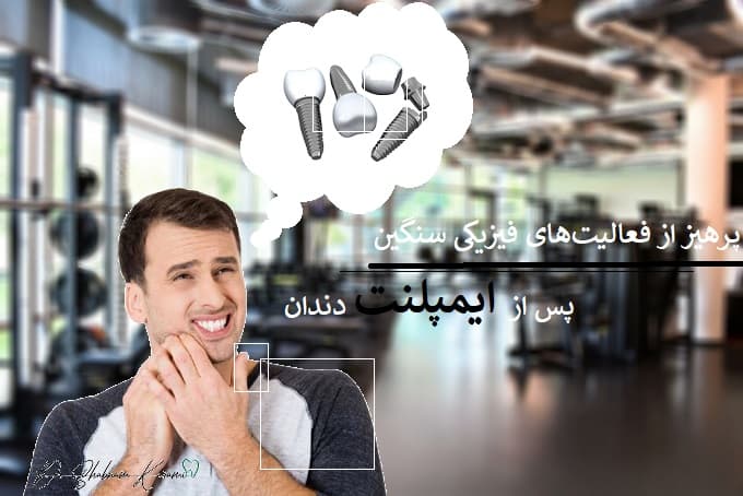 پرهیز از فعالیت‌های فیزیکی سنگین پس از ایمپلنت دندان