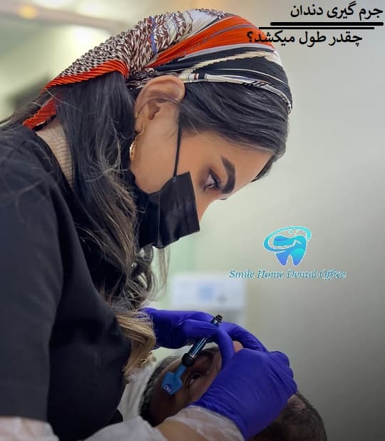 جرم گیری دندان چقدر طول میکشد؟