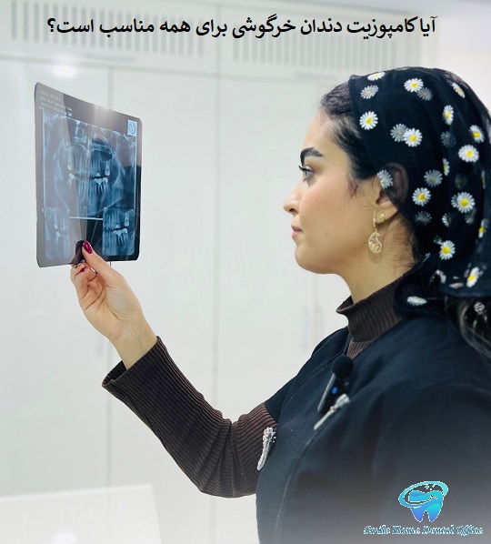 آیا کامپوزیت دندان خرگوشی برای همه مناسب است؟