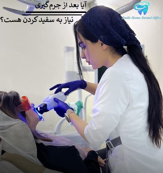 آیا بعد از جرم‌گیری نیاز به سفید کردن هست؟