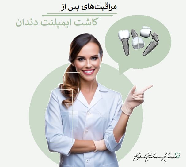 مراقبت‌های پس از کاشت ایمپلنت دندان