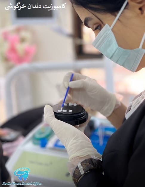 کامپوزیت دندان خرگوشی