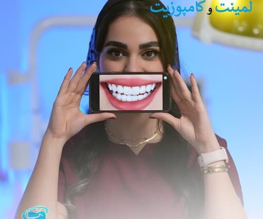 علت تفاوت قیمت لمینت و کامپوزیت
