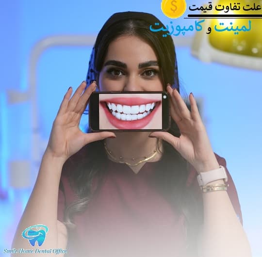 علت تفاوت قیمت لمینت و کامپوزیت