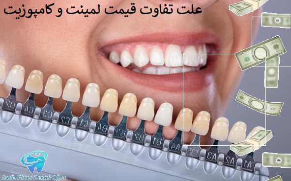 علت تفاوت قیمت لمینت و کامپوزیت