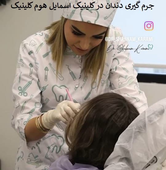 جرم گیری دندان در کلینیک اسمایل هوم کلینیک