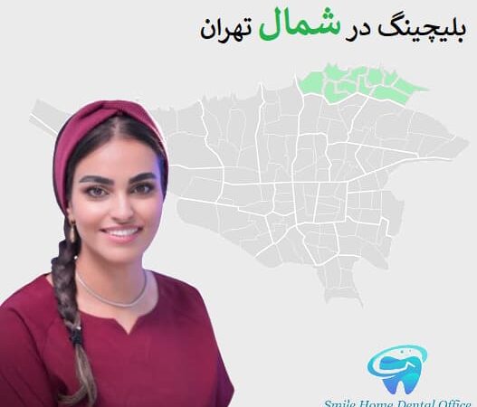 بلیچینگ در شمال تهران