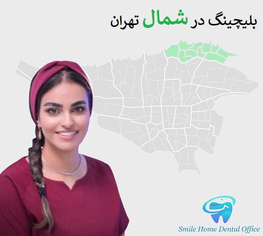 بلیچینگ در شمال تهران