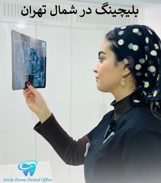 بلیچینگ در شمال تهران