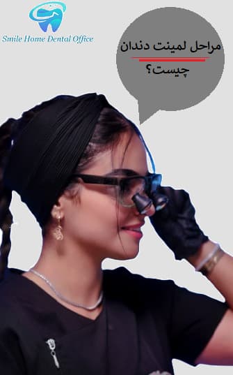 مراحل لمینت دندان چیست؟
