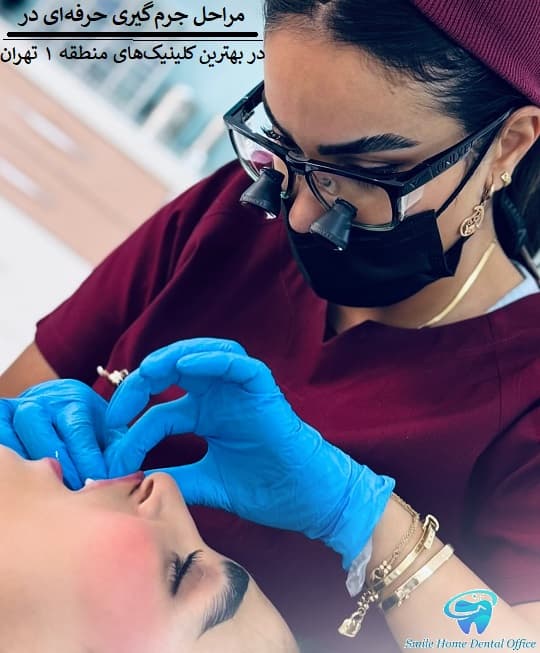 مراحل جرم‌گیری حرفه‌ای در بهترین کلینیک‌های منطقه ۱ تهران