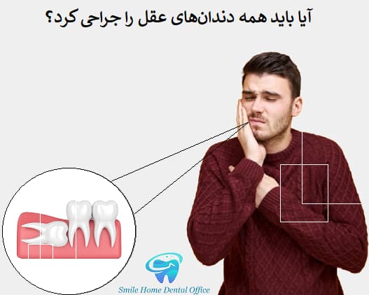 آیا باید همه دندان‌های عقل را جراحی کرد؟