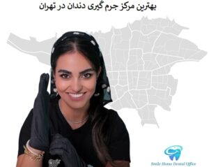 بهترین مرکز جرم گیری دندان در تهران