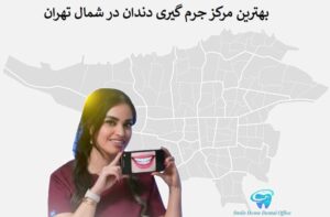 بهترین مرکز جرم گیری دندان در شمال تهران