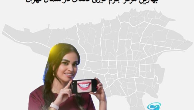 بهترین مرکز جرم گیری دندان در شمال تهران