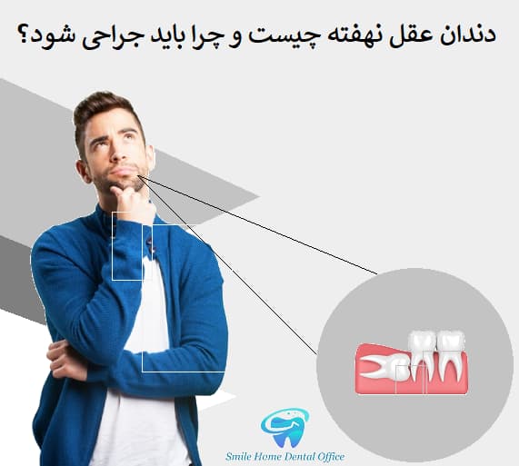 دندان عقل نهفته چیست و چرا باید جراحی شود؟