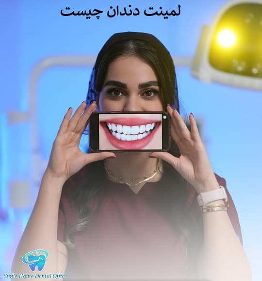 لمینت دندان چیست