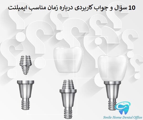 ۱۰ سؤال و جواب کاربردی درباره زمان مناسب ایمپلنت