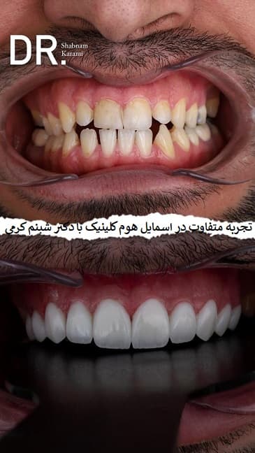 تجربه متفاوت در اسمایل هوم کلینیک با دکتر شبنم کرمی