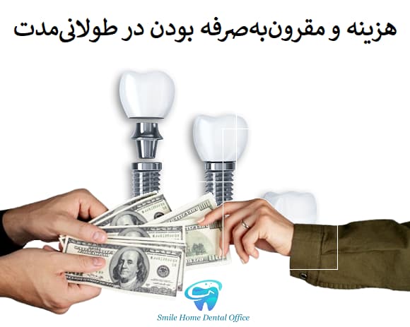 هزینه و مقرون‌به‌صرفه بودن در طولانی‌مدت