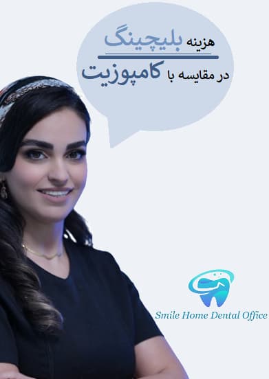 هزینه بلیچینگ در مقایسه با کامپوزیت