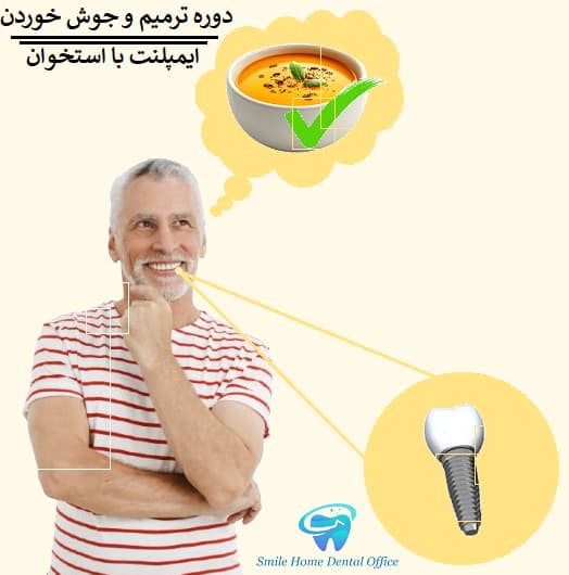 دوره ترمیم و جوش خوردن ایمپلنت با استخوان