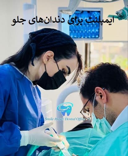 ایمپلنت برای دندان‌های جلو 