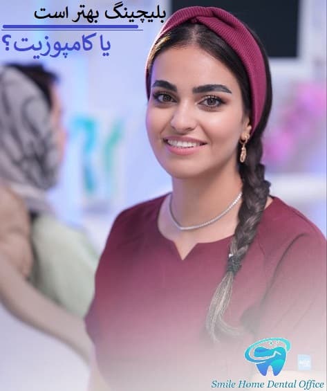 بلیچینگ بهتر است یا کامپوزیت 