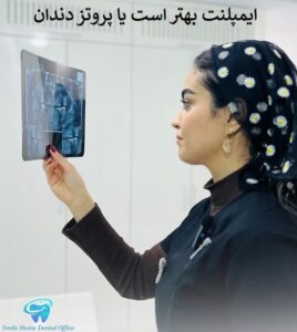 ایمپلنت بهتر است یا پروتز دندان