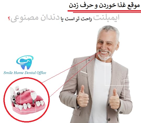 موقع غذا خوردن و حرف زدن، ایمپلنت راحت تر است یا دندان مصنوعی؟ 