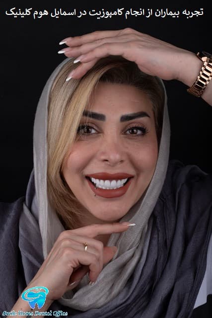 تجربه بیماران از انجام کامپوزیت در اسمایل هوم کلینیک 