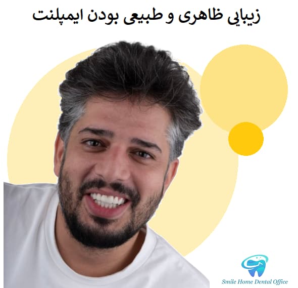 زیبایی ظاهری و طبیعی بودن ایمپلنت