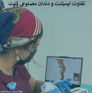 تفاوت ایمپلنت و دندان مصنوعی ثابت