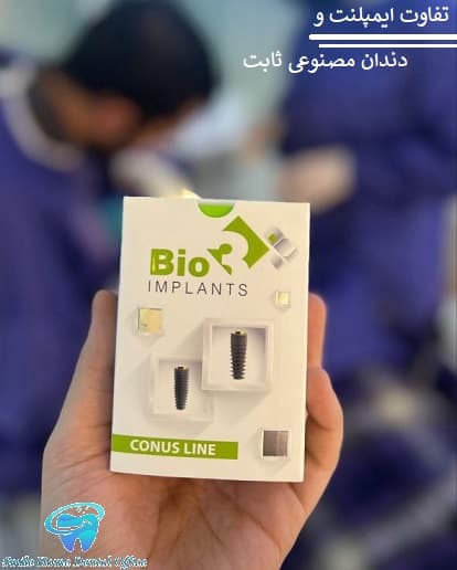 تفاوت ایمپلنت و دندان مصنوعی ثابت