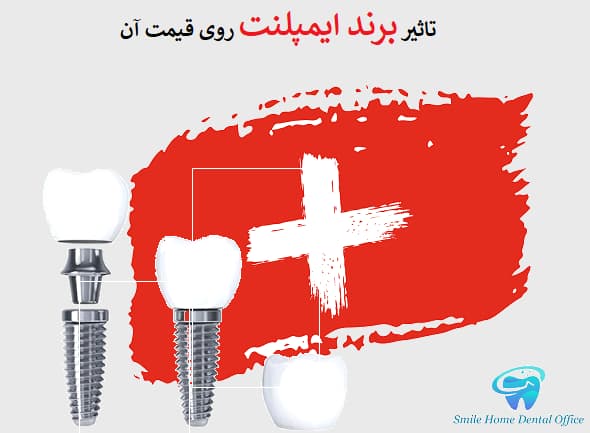 تاثیر برند ایمپلنت روی قیمت آن 